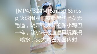 [MP4/ 324M]&nbsp;&nbsp;火速围观，露脸黑丝骚女无毛逼，阴蒂很大长的像小鸡巴一样，让小哥抠逼道具玩弄搞喷水，交大鸡巴无套内射